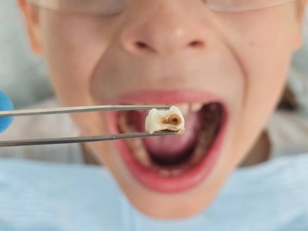 Best Emergency Treatment for Toothache in Mountain Lake Park, MD
