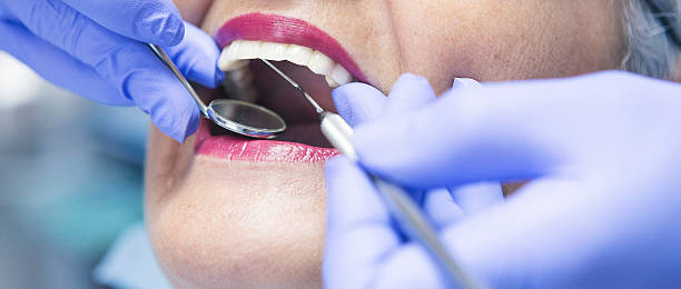 Best Emergency Broken Tooth Repair in Mountain Lake Park, MD