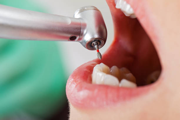 Best Weekend Emergency Dentist in Mountain Lake Park, MD